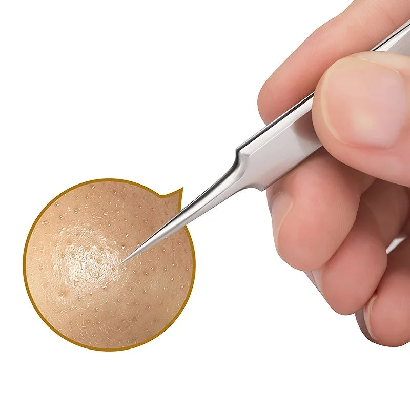 Fine Tip Stainless Steel Acne Clip, Acne Removal Tweezers, Facial Blackhead Extraction Facial Cleansing Skin Care Tools