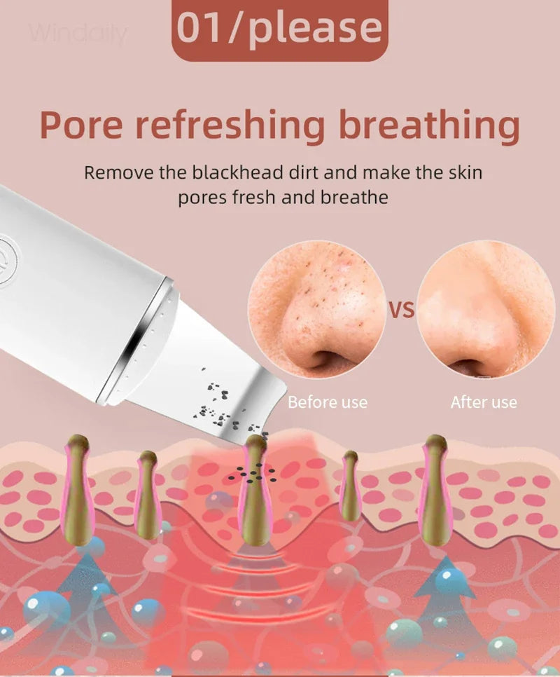 Ultrasonic Skin Care Spatula Vibration Blackhead Remover Cavitation Shovel Facial Exfoliation Skin Care Tools
