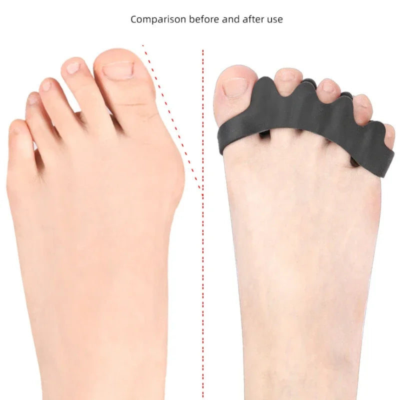 1Pairs Toe Separators Thumb Valgus Bunion Adjuster Gel Splitter Hammer Corrector Protector Foot Pain Relief Silicone Straighten