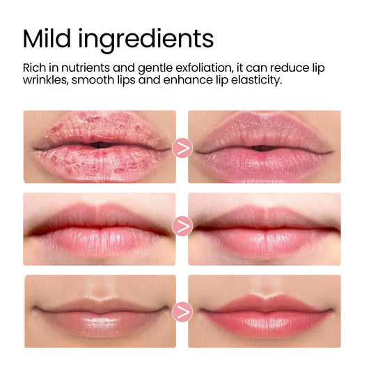 Lip Sleeping Mask Fading Lip Wrinkles Removing Keratin Improving Dryness Peeling Moisturizing & Nourishing Lip Care Products